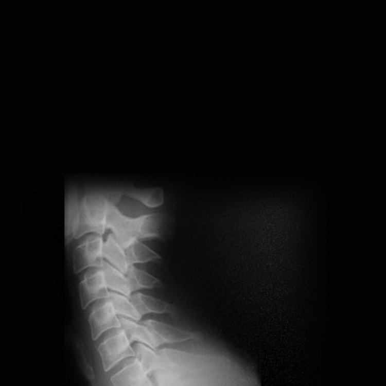 Internal-Page-Banner-HerniaticandSPinal.jpg