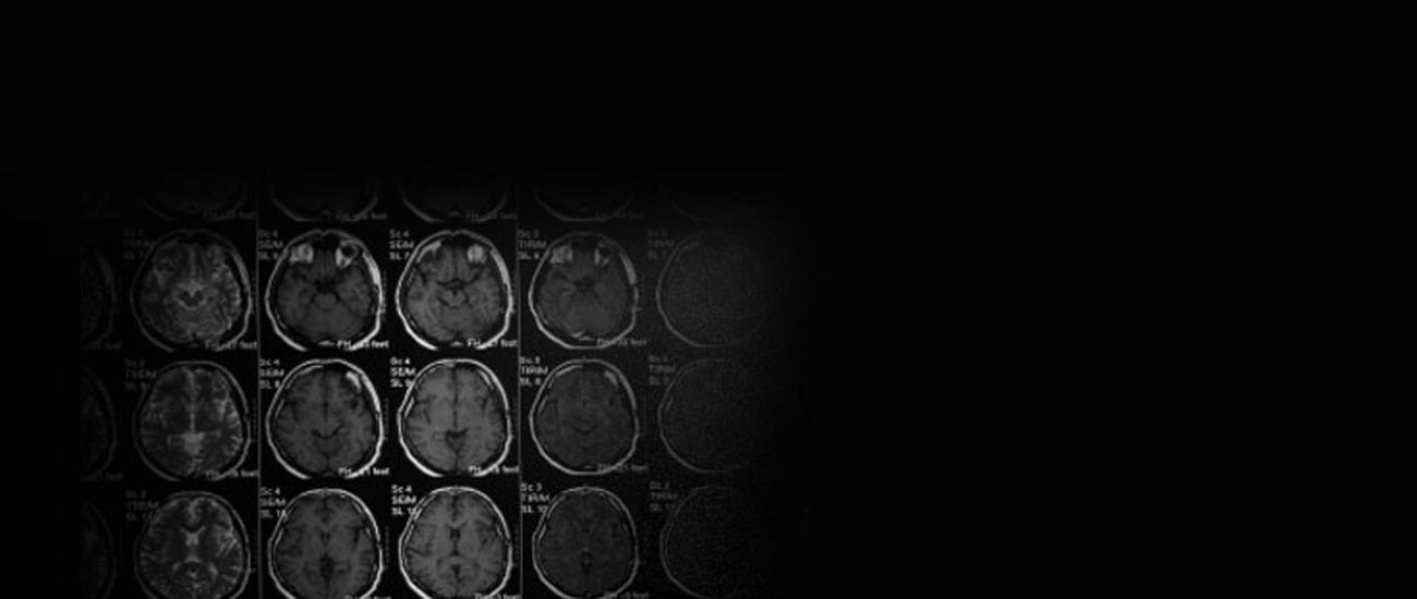 Brain Injury